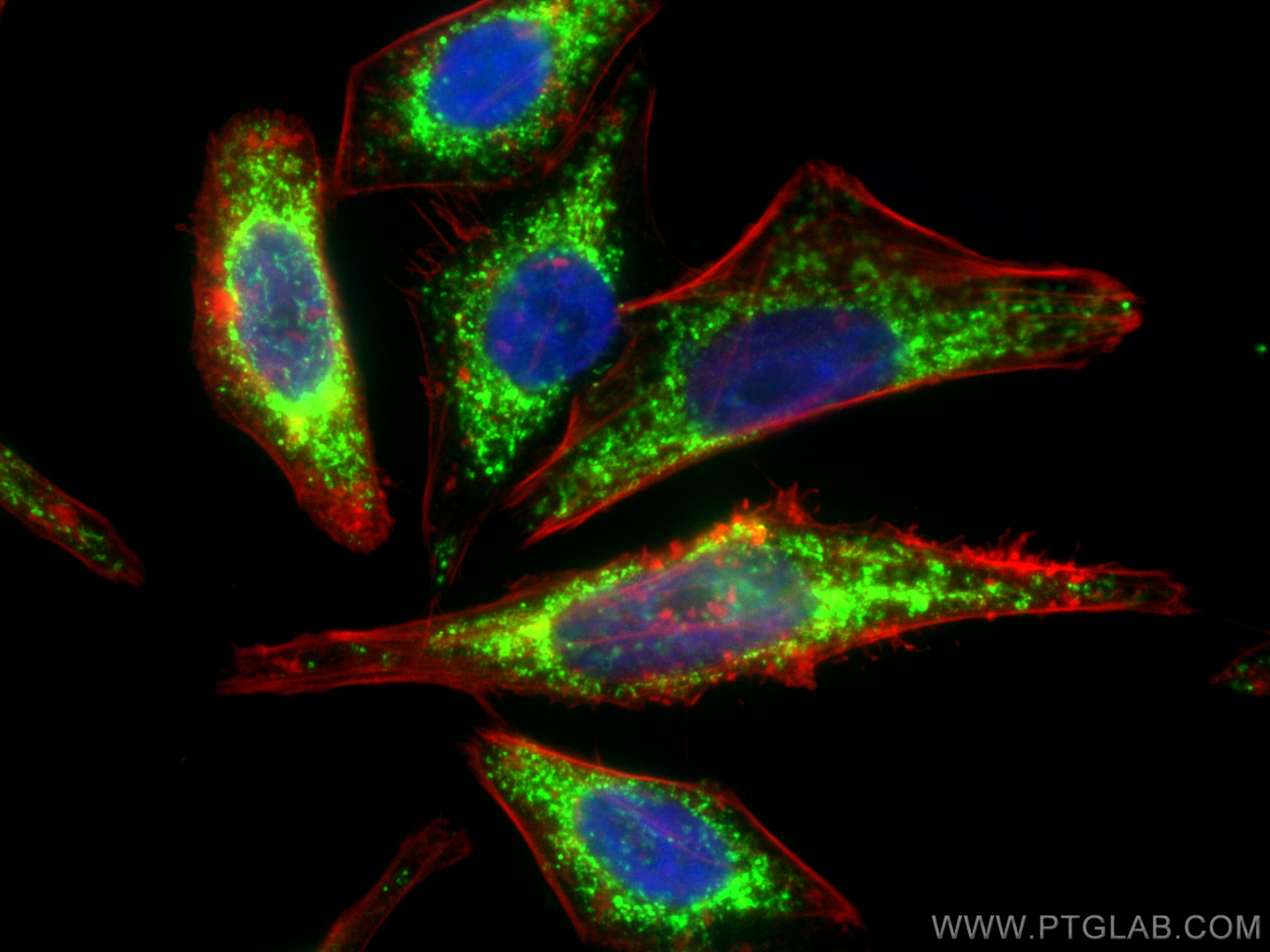 IF Staining of HepG2 using 10325-1-AP