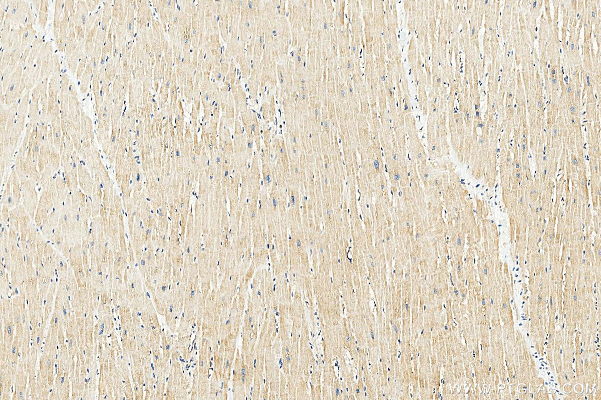IHC staining of human heart using 10325-1-AP Immunohistochemistry (IHC) staining of human heart tissue using TRAP1 Polyclonal antibody (10325-1-AP)