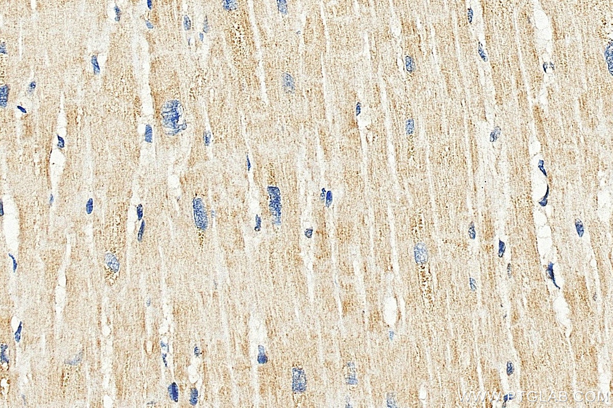 IHC staining of human heart using 10325-1-AP Immunohistochemistry (IHC) staining of human heart tissue using TRAP1 Polyclonal antibody (10325-1-AP)