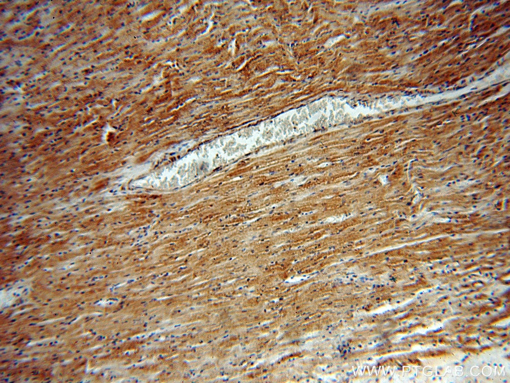 IHC staining of human heart using 10325-1-AP