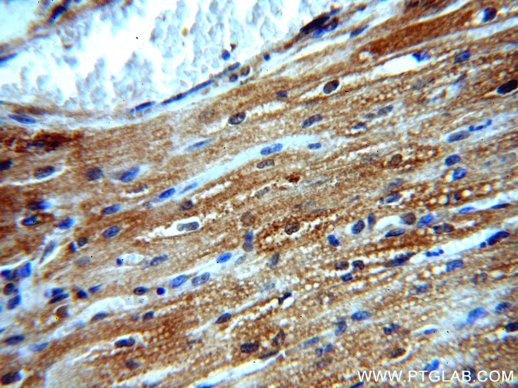 IHC staining of human heart using 10325-1-AP