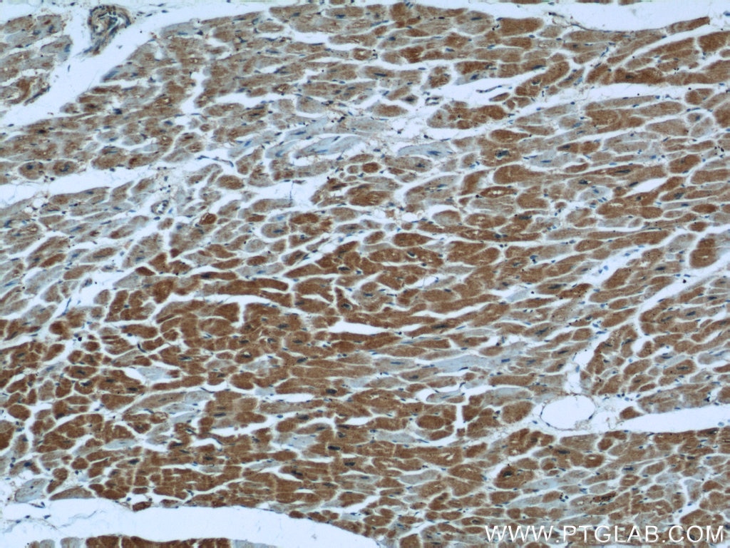 Immunohistochemistry (IHC) staining of human heart tissue using TRAP1 Polyclonal antibody (10325-1-AP)