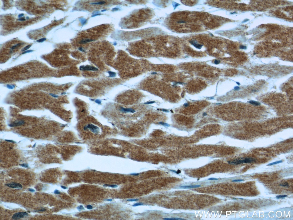 Immunohistochemistry (IHC) staining of human heart tissue using TRAP1 Polyclonal antibody (10325-1-AP)