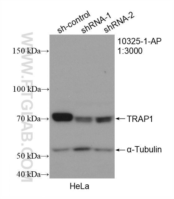Western Blot (WB) analysis of HeLa cells using TRAP1 Polyclonal antibody (10325-1-AP)