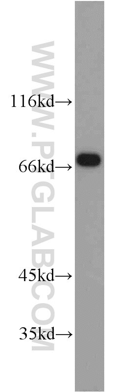 Western Blot (WB) analysis of mouse heart tissue using TRAP1 Polyclonal antibody (10325-1-AP)