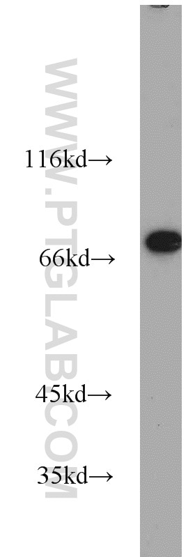 Western Blot (WB) analysis of Raji cells using TRAP1 Polyclonal antibody (10325-1-AP)