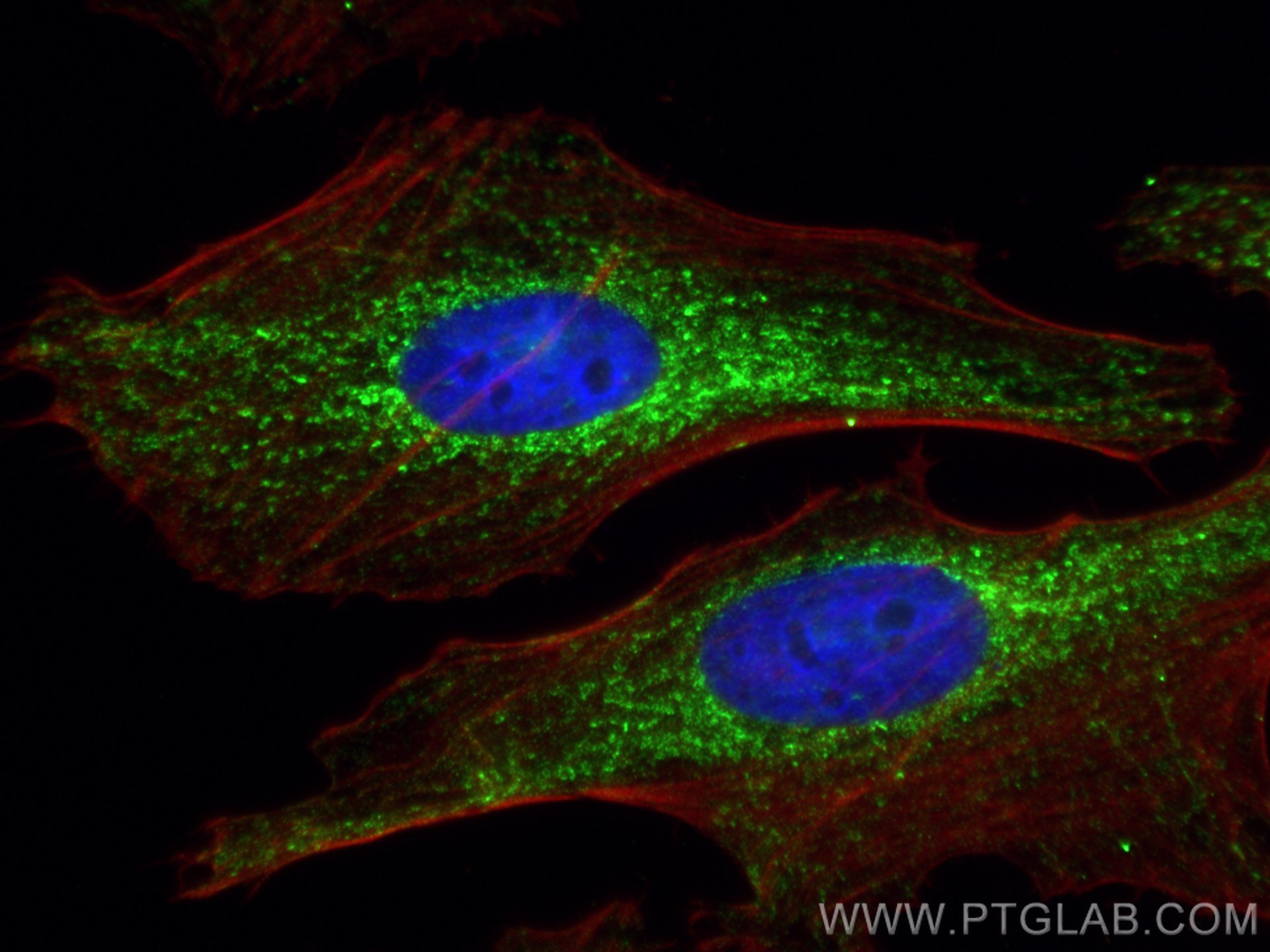 Immunofluorescence (IF) / fluorescent staining of HeLa cells using TRAP1 Monoclonal antibody (67693-1-Ig)
