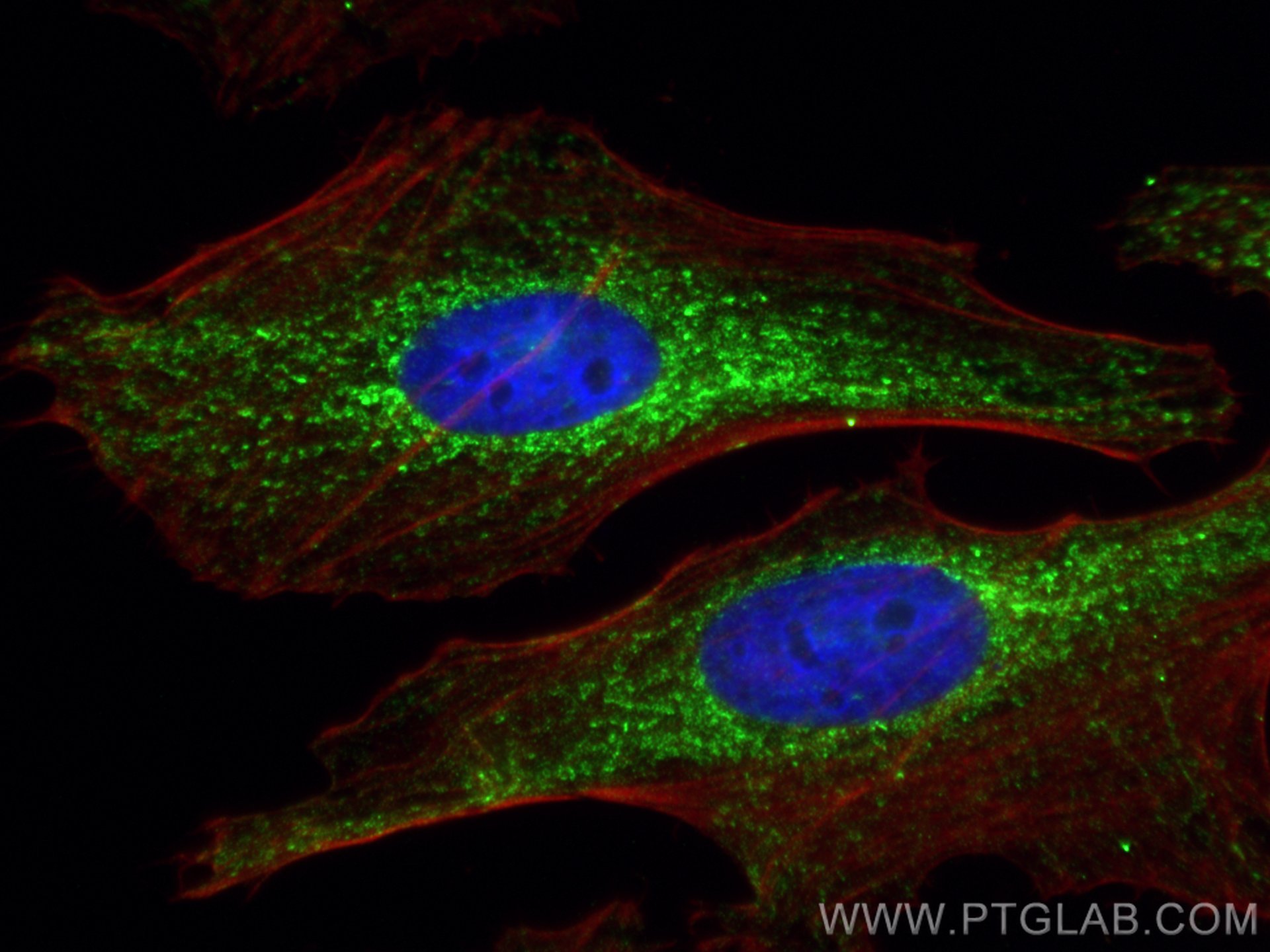 IF Staining of HeLa using 67693-1-Ig