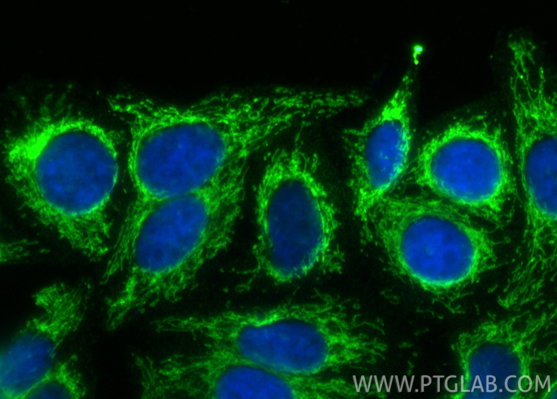 Immunofluorescence (IF) / fluorescent staining of HepG2 cells using TRAP1 Monoclonal antibody (67693-1-Ig)