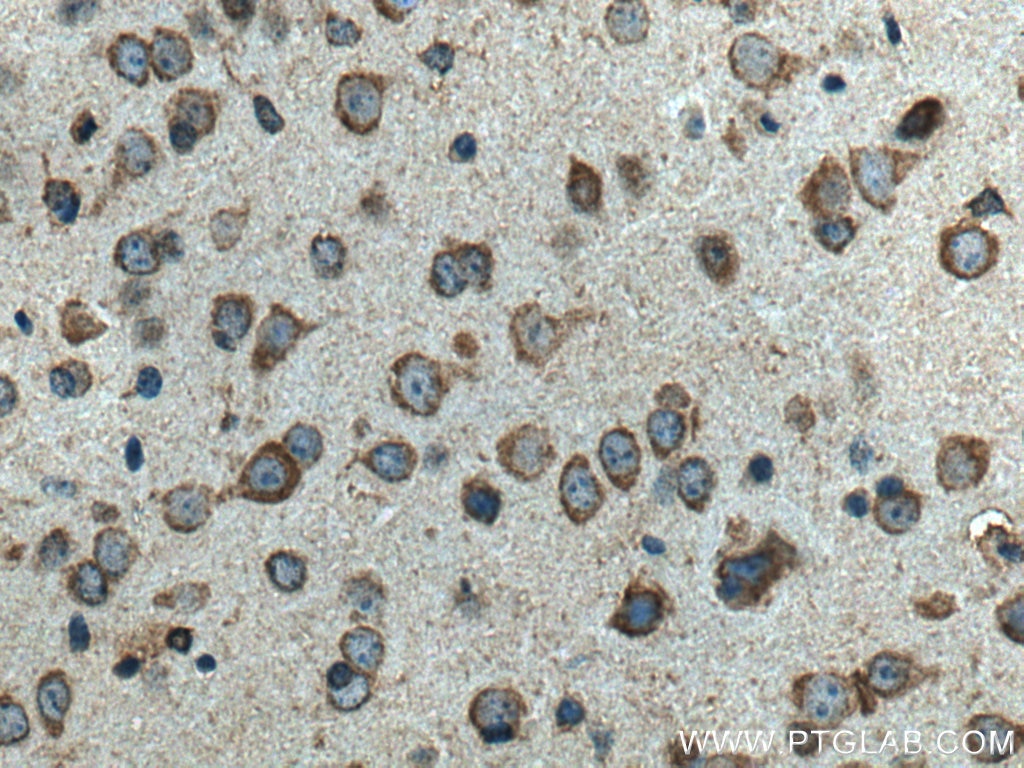 Immunohistochemistry (IHC) staining of mouse brain tissue using TRAP1 Monoclonal antibody (67693-1-Ig)