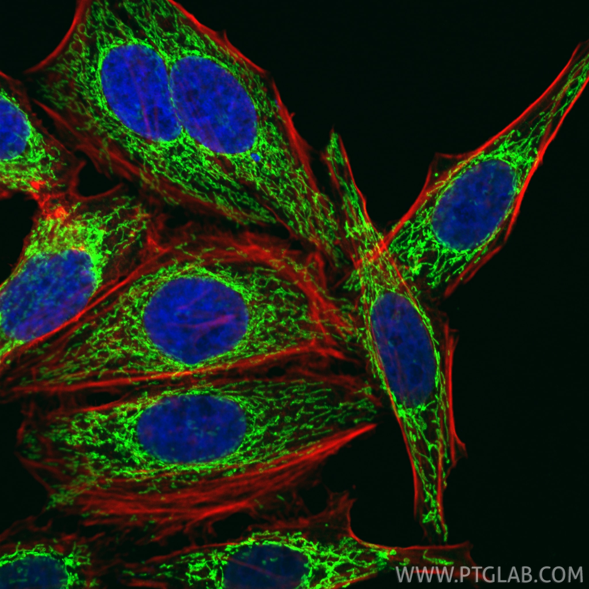 IF Staining of HepG2 using CL488-10325 Immunofluorescence (IF) / fluorescent staining of HepG2 cells using CoraLite® Plus 488-conjugated TRAP1 Polyclonal ant (CL488-10325)