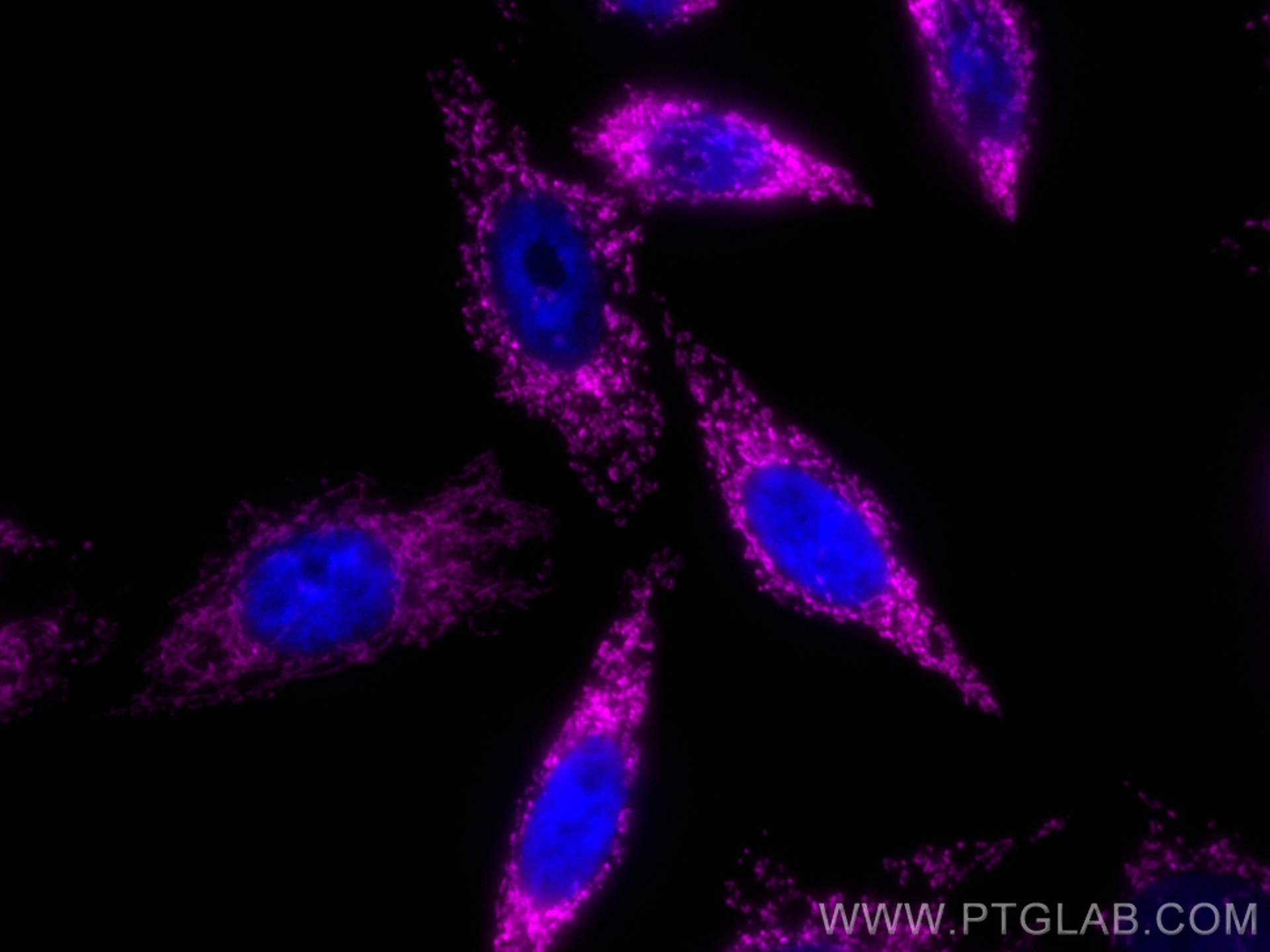 Immunofluorescence (IF) / fluorescent staining of HepG2 cells using CoraLite® Plus 647-conjugated TRAP1 Polyclonal ant (CL647-10325)