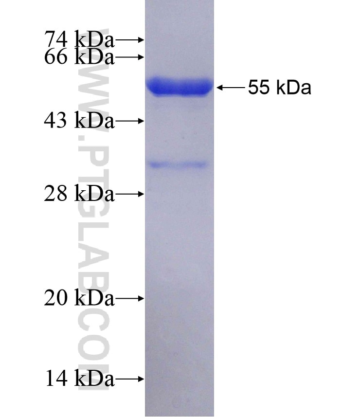TRAP1 fusion protein Ag0400 SDS-PAGE