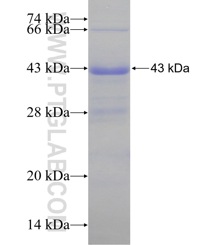 TRAPA, SSR1 fusion protein Ag30832 SDS-PAGE