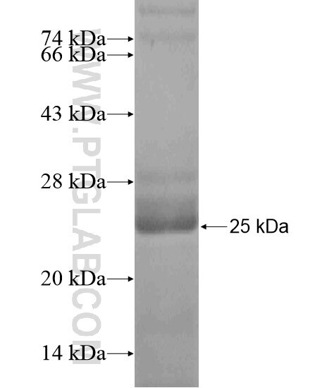 TRAPB, SSR2 fusion protein Ag20358 SDS-PAGE