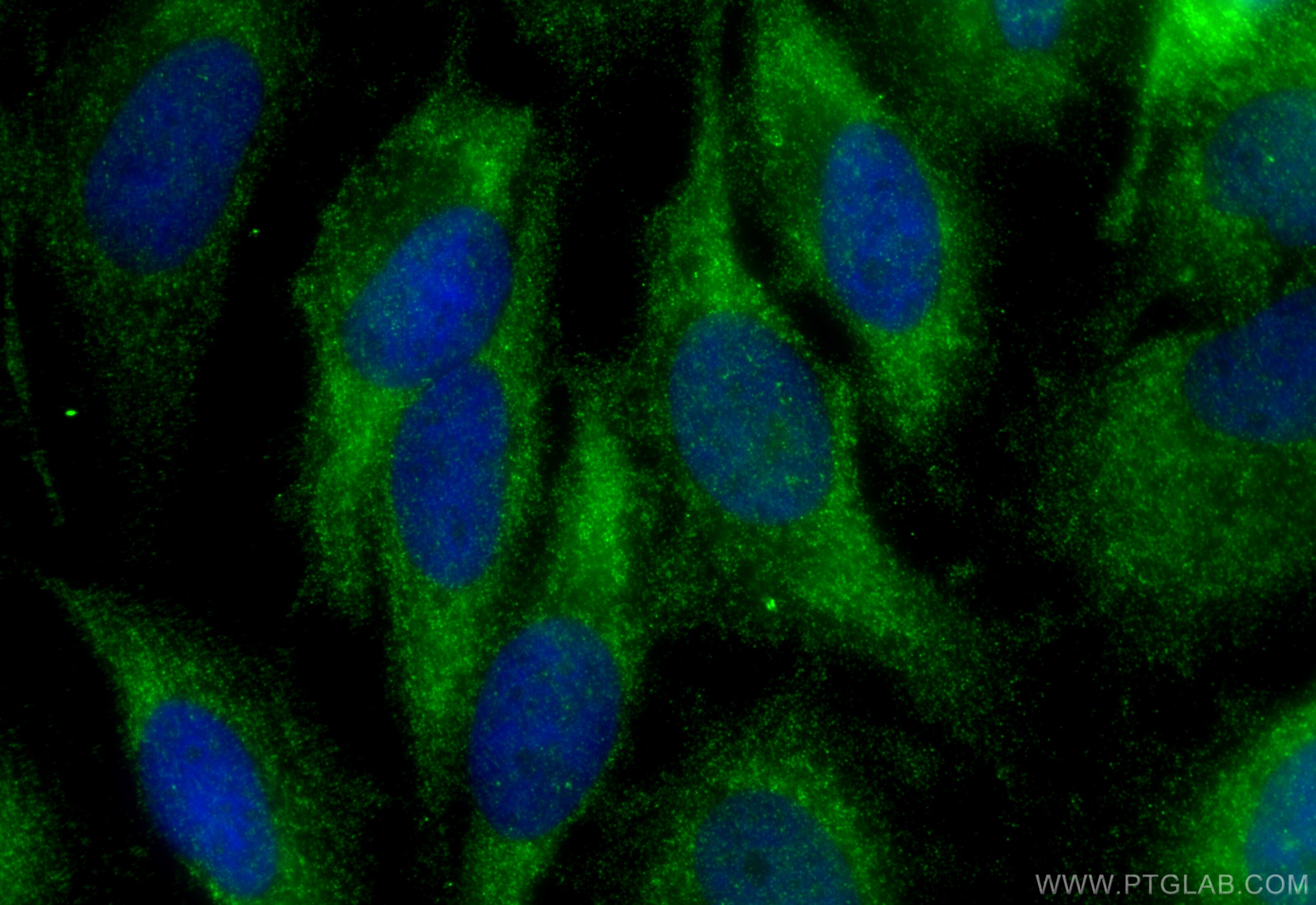 Immunofluorescence (IF) / fluorescent staining of HeLa cells using TRAPPC1 Polyclonal antibody (13868-1-AP)