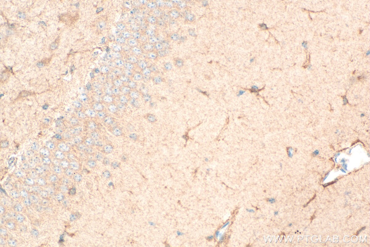 Immunohistochemistry (IHC) staining of mouse brain tissue using TRAPPC1 Polyclonal antibody (13868-1-AP)