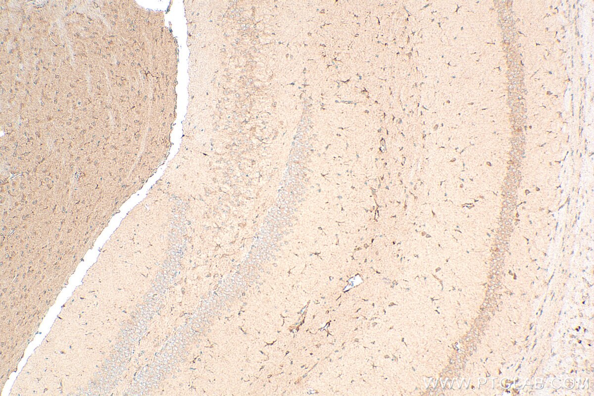 Immunohistochemistry (IHC) staining of mouse brain tissue using TRAPPC1 Polyclonal antibody (13868-1-AP)