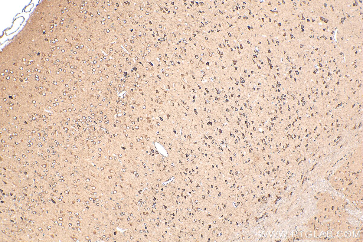 Immunohistochemistry (IHC) staining of mouse brain tissue using TRAPPC1 Polyclonal antibody (19598-1-AP)