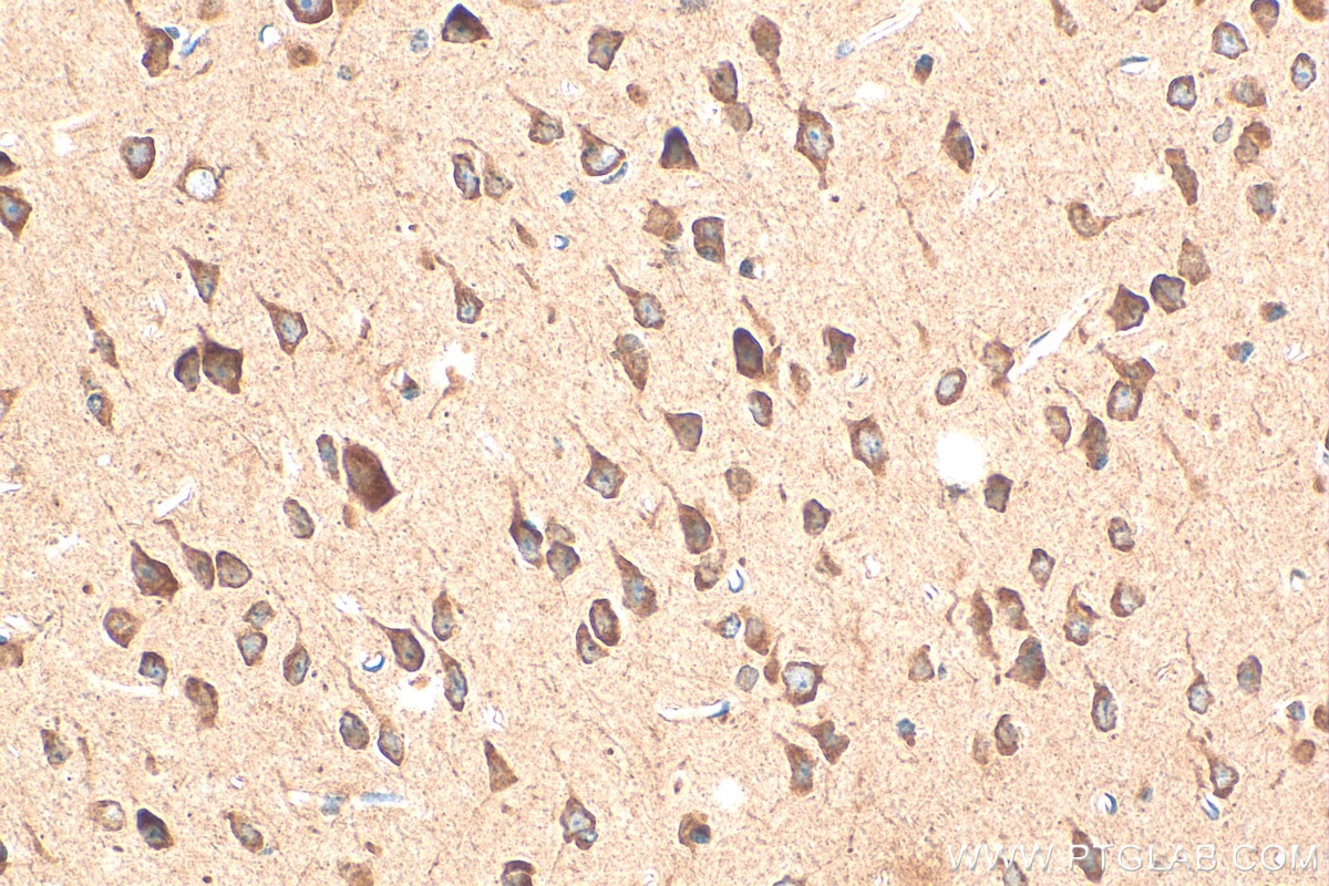Immunohistochemistry (IHC) staining of mouse brain tissue using TRAPPC1 Polyclonal antibody (19598-1-AP)