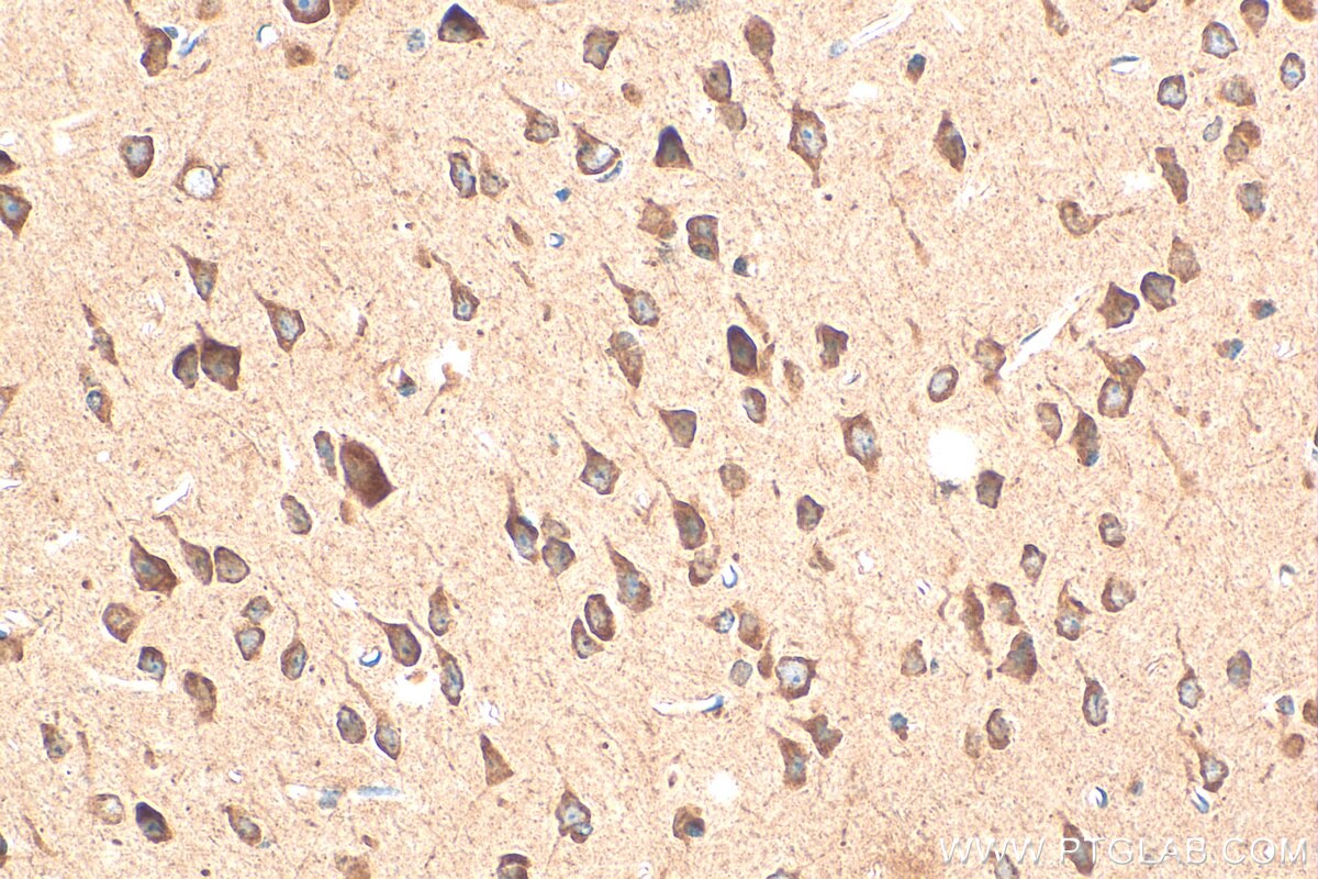 Immunohistochemistry (IHC) staining of mouse brain tissue using TRAPPC1 Polyclonal antibody (19598-1-AP)