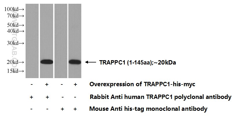 TRAPPC1