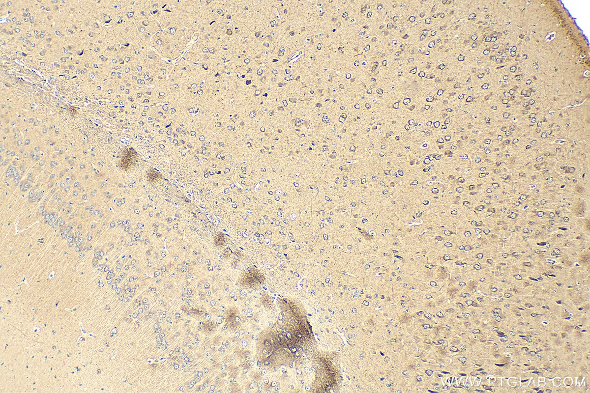 Immunohistochemistry (IHC) staining of mouse brain tissue using TRAPPC10 Polyclonal antibody (27549-1-AP)