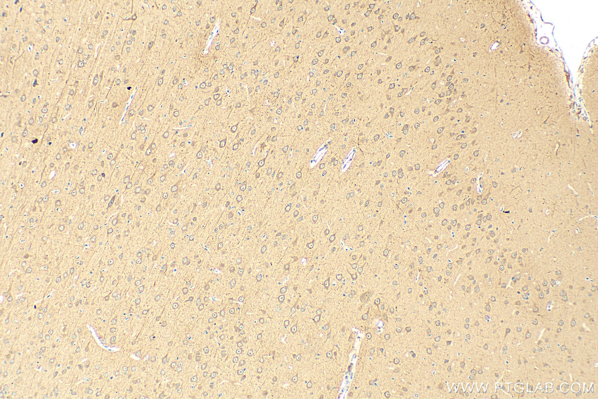 Immunohistochemistry (IHC) staining of rat brain tissue using TRAPPC10 Polyclonal antibody (27549-1-AP)