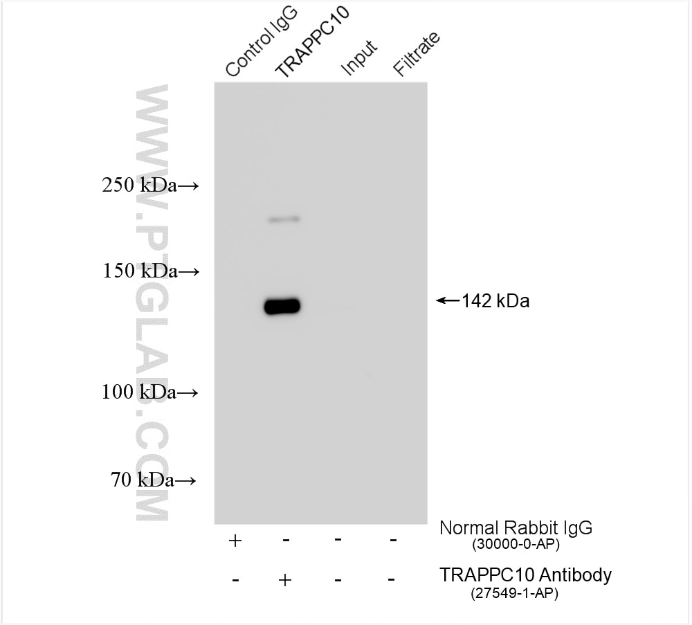 Immunoprecipitation (IP) experiment of mouse brain tissue using TRAPPC10 Polyclonal antibody (27549-1-AP)