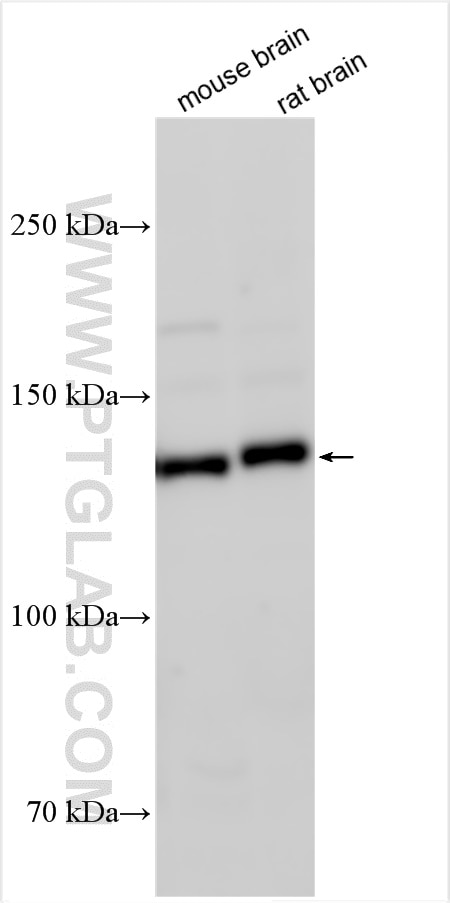 Western Blot (WB) analysis of various lysates using TRAPPC10 Polyclonal antibody (27549-1-AP)