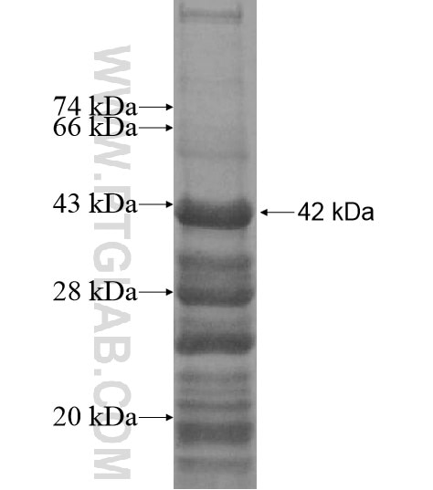 TRAPPC10 fusion protein Ag12696 SDS-PAGE TRAPPC10 fusion protein Ag12696 SDS-PAGE
