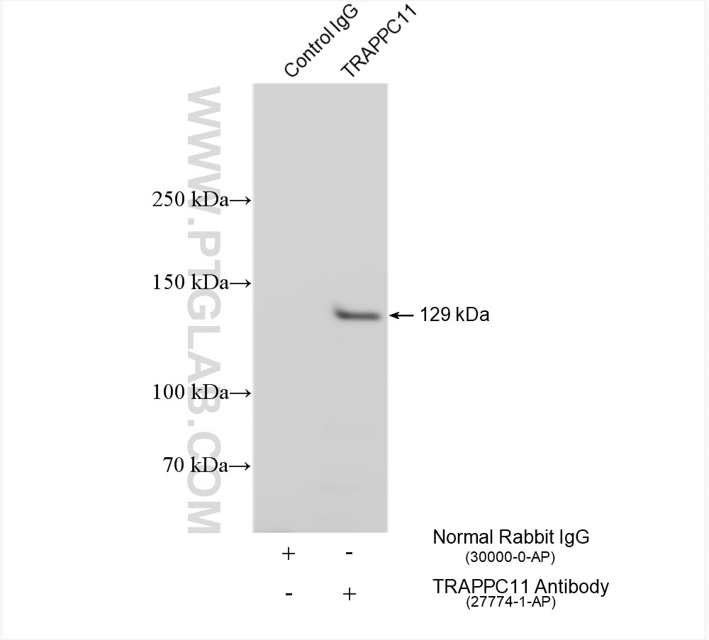 Immunoprecipitation (IP) experiment of HeLa cells using TRAPPC11 Polyclonal antibody (27774-1-AP)