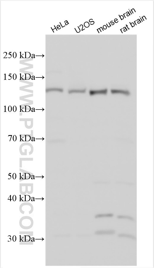 Western Blot (WB) analysis of various lysates using TRAPPC11 Polyclonal antibody (27774-1-AP)