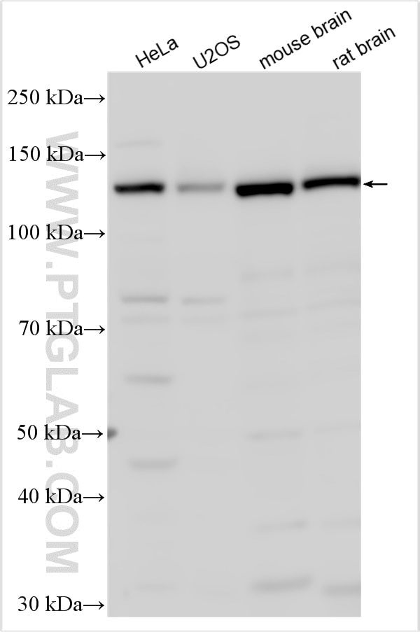 Western Blot (WB) analysis of various lysates using TRAPPC11 Polyclonal antibody (27774-1-AP)