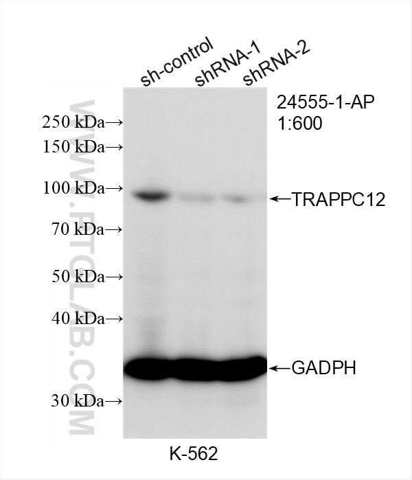 Western Blot (WB) analysis of K-562 cells using TRAPPC12 Polyclonal antibody (24555-1-AP)