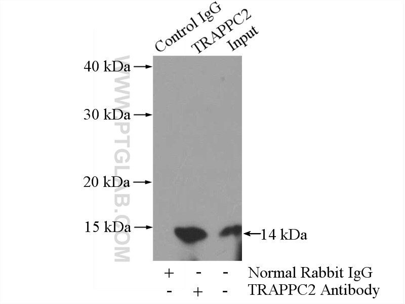 Immunoprecipitation (IP) experiment of PC-3 cells using TRAPPC2 Polyclonal antibody (12484-1-AP)