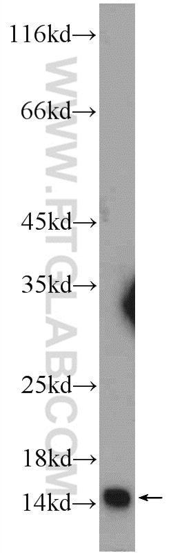 Western Blot (WB) analysis of mouse brain tissue using TRAPPC2 Polyclonal antibody (12484-1-AP)