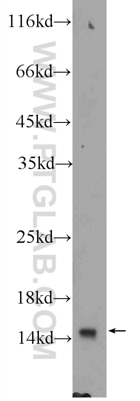 Western Blot (WB) analysis of mouse thymus tissue using TRAPPC2 Polyclonal antibody (12484-1-AP)