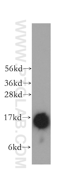 Western Blot (WB) analysis of human brain tissue using TRAPPC2 Polyclonal antibody (12484-1-AP)