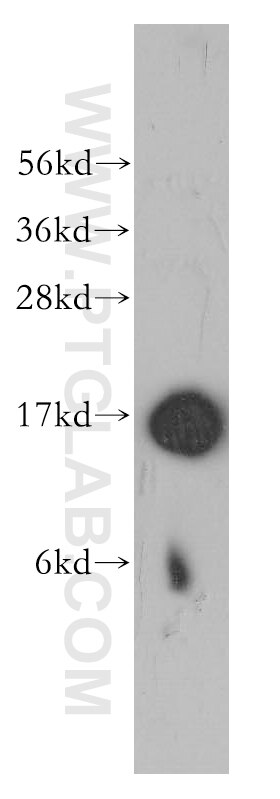 Western Blot (WB) analysis of PC-3 cells using TRAPPC2 Polyclonal antibody (12484-1-AP)