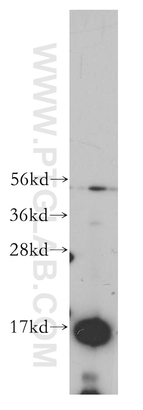 Western Blot (WB) analysis of human liver tissue using TRAPPC2 Polyclonal antibody (12484-1-AP)