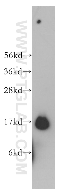 Western Blot (WB) analysis of human lung tissue using TRAPPC2 Polyclonal antibody (12484-1-AP)