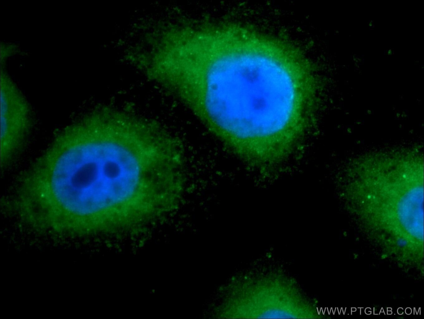 Immunofluorescence (IF) / fluorescent staining of HepG2 cells using TRAPPC2L Polyclonal antibody (25282-1-AP)