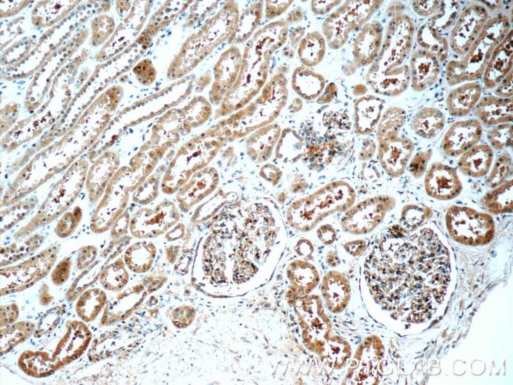 Immunohistochemistry (IHC) staining of human kidney tissue using TRAPPC2L Polyclonal antibody (25282-1-AP)