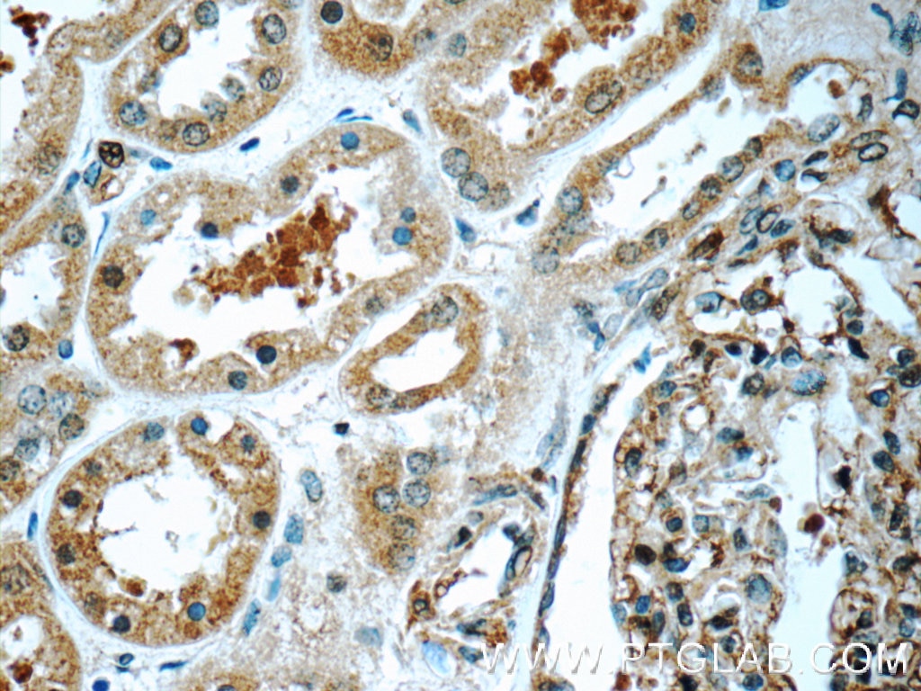 Immunohistochemistry (IHC) staining of human kidney tissue using TRAPPC2L Polyclonal antibody (25282-1-AP)