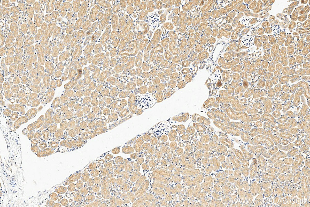 Immunohistochemistry (IHC) staining of mouse kidney tissue using TRAPPC2L Polyclonal antibody (25282-1-AP)