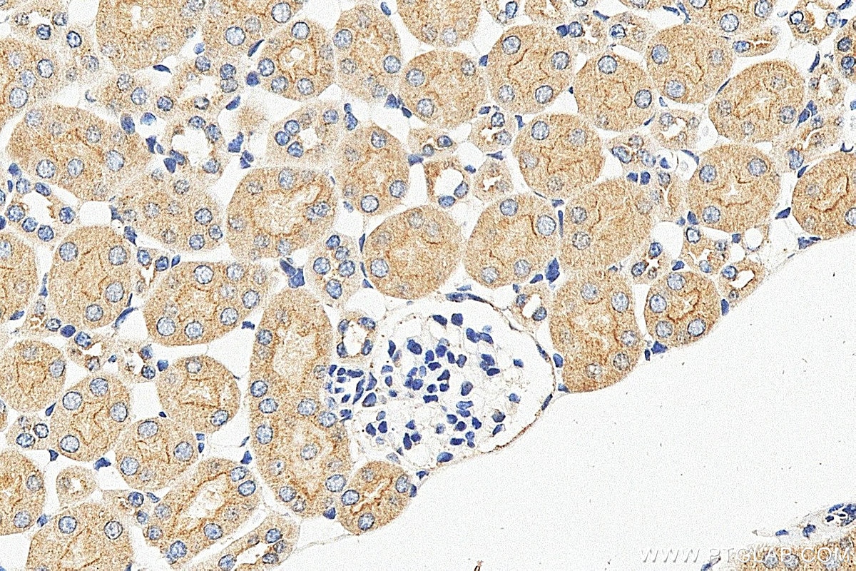 Immunohistochemistry (IHC) staining of mouse kidney tissue using TRAPPC2L Polyclonal antibody (25282-1-AP)