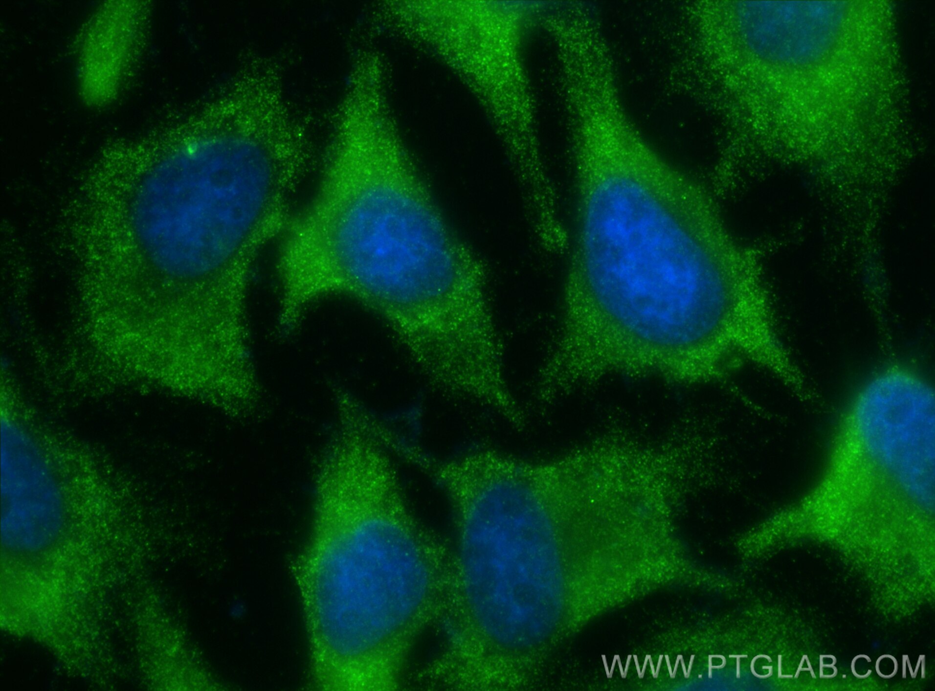 Immunofluorescence (IF) / fluorescent staining of HeLa cells using TRAPPC3 Polyclonal antibody (15555-1-AP)