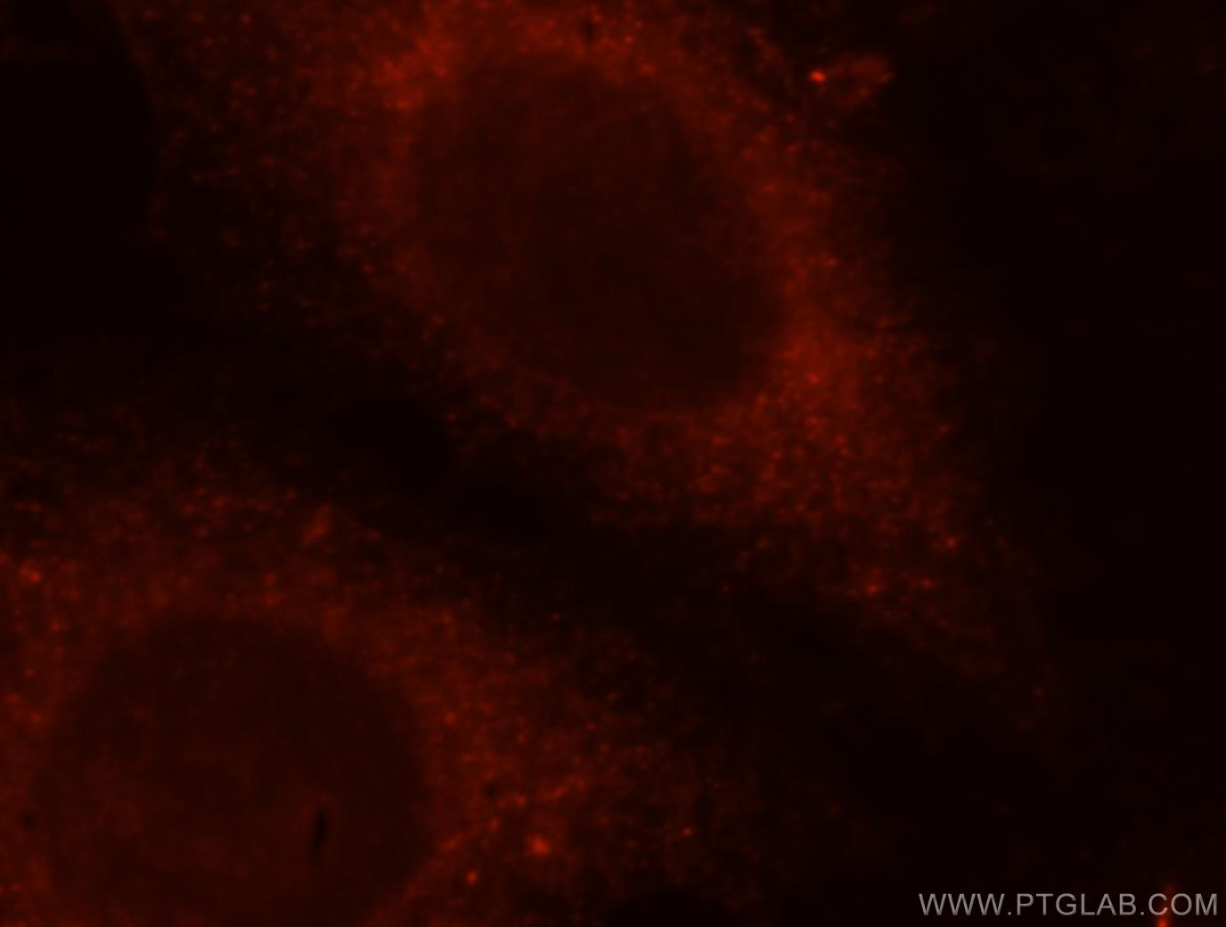 Immunofluorescence (IF) / fluorescent staining of HeLa cells using TRAPPC3 Polyclonal antibody (15555-1-AP)