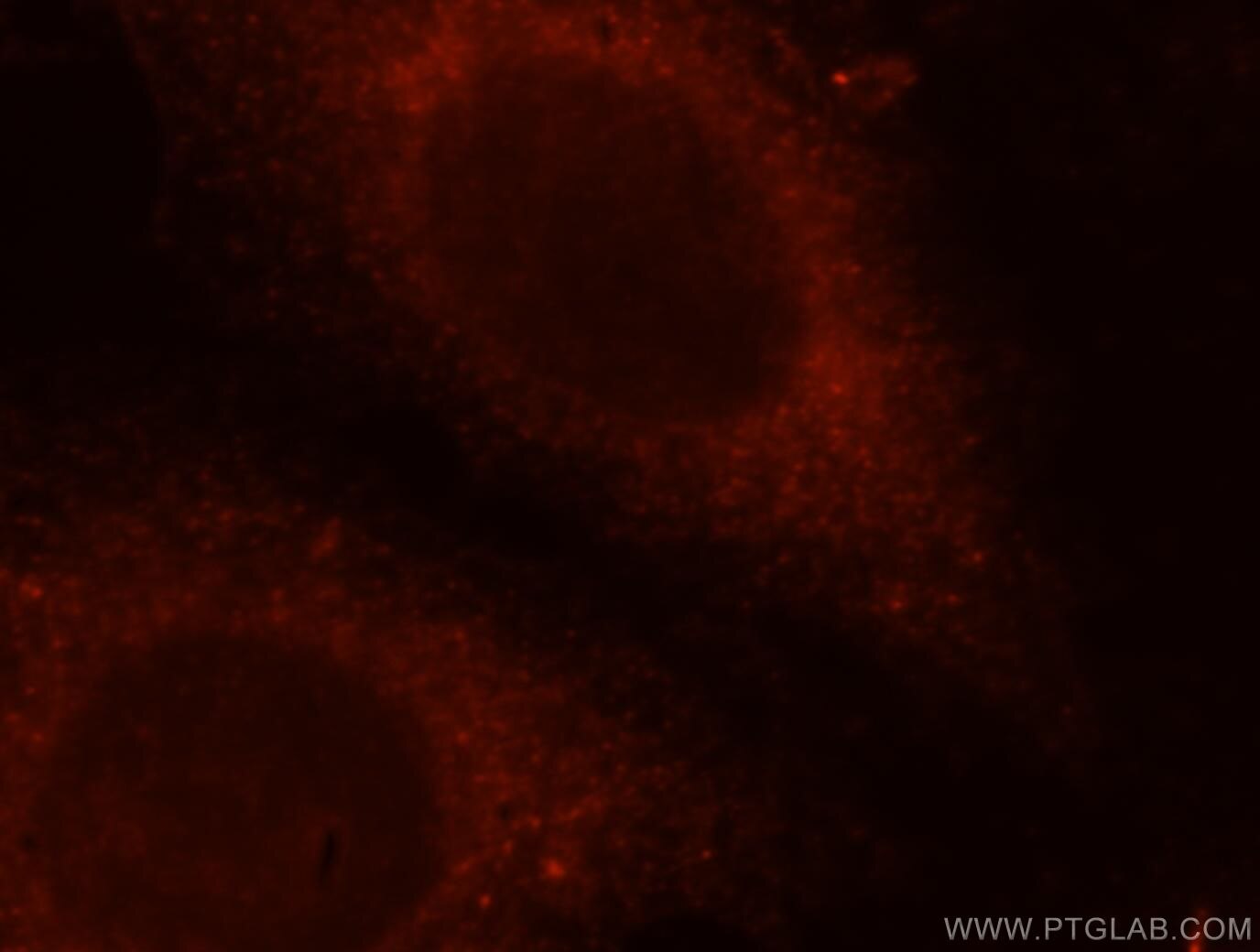 Immunofluorescence (IF) / fluorescent staining of HeLa cells using TRAPPC3 Polyclonal antibody (15555-1-AP)